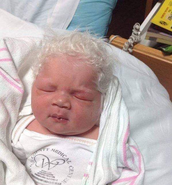 نوزاد با موهای سفید