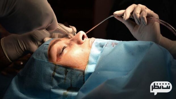دکتر عزت الله رضایی فوق تخصص جراحی پلاستیک و جراح بینی